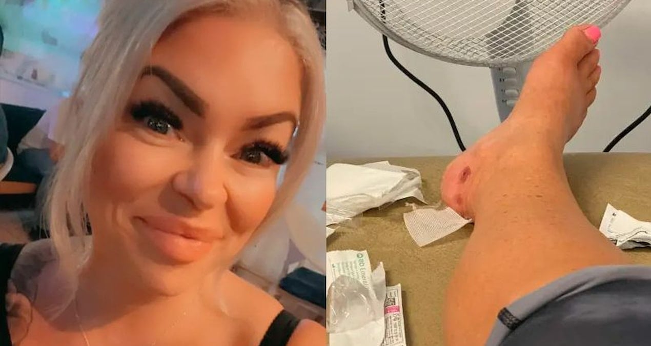 ingiliz kadinin bodrumdaki luks otelde yaptigi tatil ulkesine donunce kabusa dondu qmwDs8yd.jpg